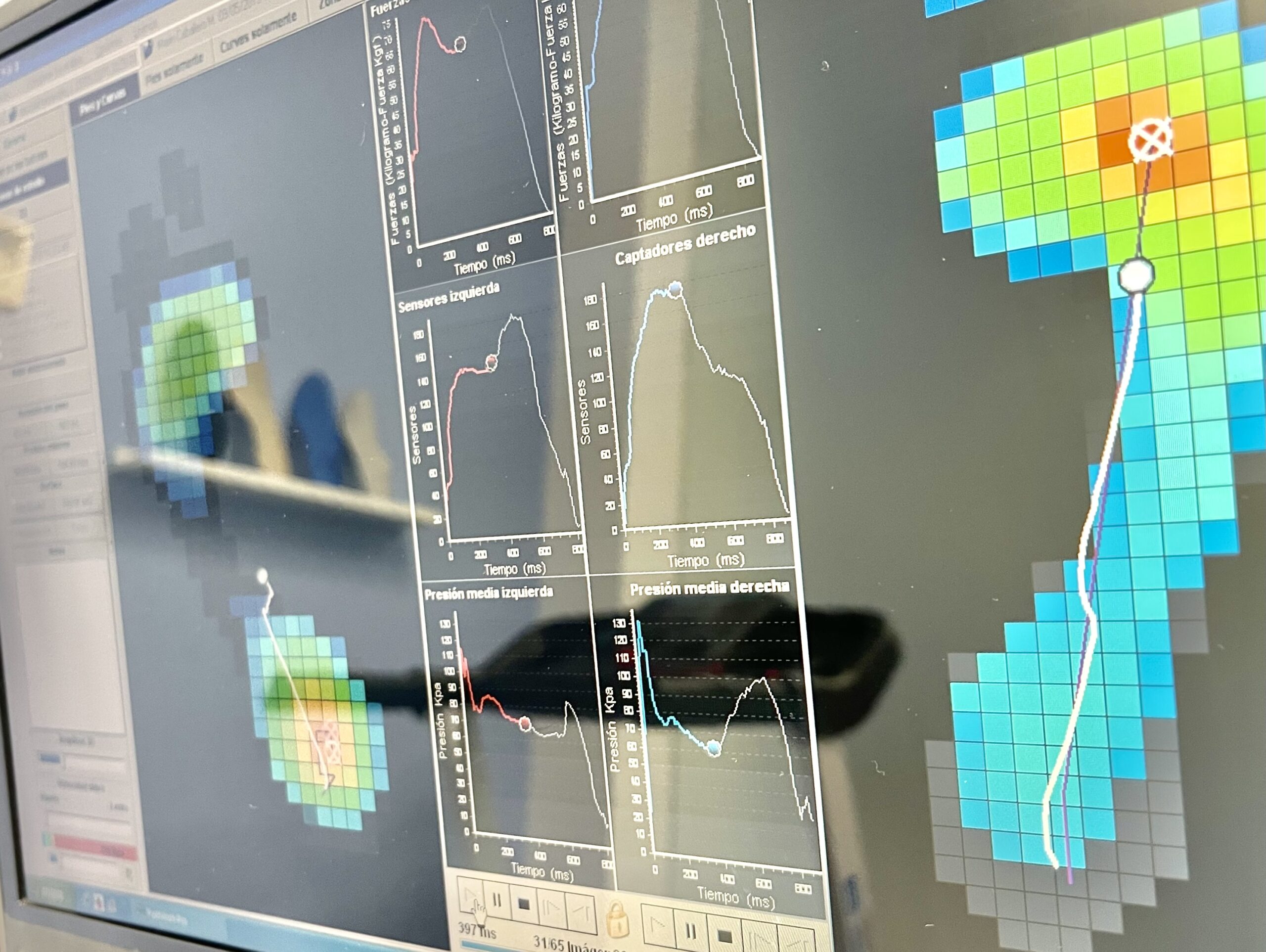 estudio de la pisada