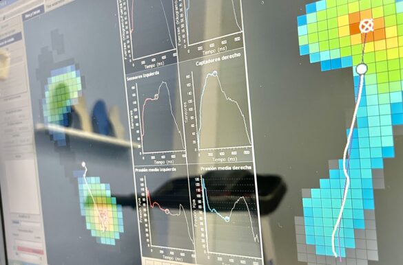 estudio de la pisada